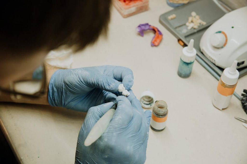 Należy mieć świadomość, że zadaniem implantów zębowych jest odbudowanie różnej liczby zębów w szczęce. Stomatolog będzie na nich umieszczał sztuczne zęby. Klienci bardzo często zastanawiają się, jak wyglądają implanty zębowe. Czym jest implant? W najprostszym możliwym ujęciu implant zęba jest tytanową śrubą wkręcaną przez implantologa w kość żuchwy lub szczęki. Warto wiedzieć, że będzie on zastępował korzeń zęba. Godny uwagi jest również fakt, że dopiero porcelanowa korona przymocowana do wspomnianego implantu będzie stanowiła kompletną rekonstrukcję określonego zęba. Do atutów omawianego rozwiązania należy zaliczyć komfort użytkowania, a także bardzo wysoką trwałość. Koniecznie trzeba zdawać sobie sprawę, że implanty stomatologiczne są niezwykle bezpieczne nawet dla alergików. Wykonane są bowiem z tytanu. Dzięki temu nie będą przyczyniały się do uczuleń. Ponadto są świetnie przyjmowane przez organizm człowieka. Obecnie zabieg polegający na wszczepieniu implantu możliwy jest do przeprowadzenia praktycznie u każdego pacjenta. Zabieg implantacji Warto wiedzieć, że implantacja jest zabiegiem chirurgicznym, który musi zostać przeprowadzony w warunkach pełnej sterylności i aseptyki. Wszczepienie będzie polegało na bardzo dokładnym przygotowaniu miejsca pod wszczep, a później odpowiednie wprowadzenie do niego implantu. Należy mieć świadomość, że miejsce na implant jest wykonywane kalibrowanymi wiertłami. Oczywiście jego wymiary muszą odpowiadać zarówno średnicy, jak i długości implantu, który zostanie w nim umieszczony. Godny uwagi jest fakt, że po wykonaniu osteotomii, implant zostaje wkręcony do otworu z właściwą siłą, która będzie gwarantowała stabilizację. Można mieć całkowitą pewność, że nie doprowadzi do przegrzania czy uszkodzenia kości. W zdecydowanej większości przypadków zabieg wszczepienia implantu będzie trwał 20 minut. Warto również wiedzieć, że pacjenci nie będą odczuwać praktycznie żadnych przykrych wrażeń w trakcie operacji, a także po niej. Jak wyglądają implanty zębowe? Po zabiegu implantacji Nie można obciążyć implantu bezpośrednio po zabiegu. Należy mieć świadomość, że czas gojenia będzie oscylował od 3 do 6 miesięcy. Bardzo dużo będzie zależało od tego, czy szczęka również została poddana zabiegowi. Koniecznie trzeba zdawać sobie sprawę, że w żuchwie wspomniany proces osteointegracji przebiega znacznie szybciej, trwa od 3 do 4 miesięcy. Istotne znaczenie dla całego procesu będą miały pierwsze dni i tygodnie od momentu zakończenia zabiegu. Wtedy mechaniczne połączenie z kością zostanie zamienione na biologiczną osteointegrację. Należy mieć świadomość, że będzie to miało miejsce od 2 do 4 tygodni od zabiegu. Nie można pod żadnym pozorem doprowadzić w tym czasie do powstania stanu zapalnego tkanek miękkich oraz kości. Mogłyby to bowiem zaburzyć cały proces. Warto wiedzieć, że w przypadku pojawienia się ewentualnego bólu, lekarz stomatolog przepisze pacjentowi leki przeciwbólowe. Zdecydowana większość osób po przeczytaniu tego artykułu będzie wiedziała, jak wyglądają implanty zębowe.